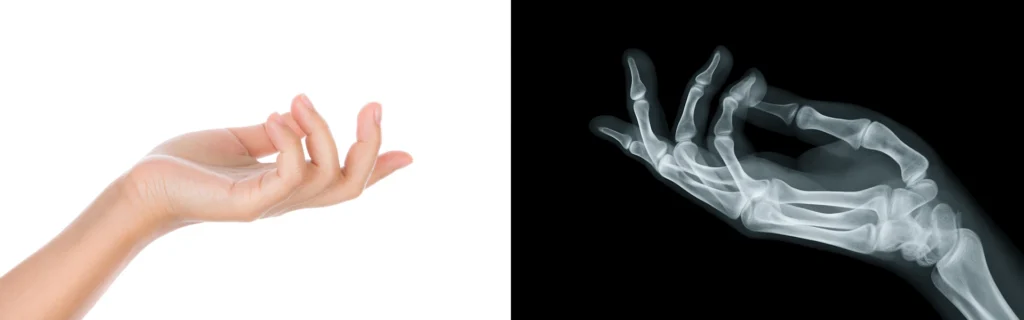 10+ Creative Ways to Use ChatGPT Image Generator (That Actually Work) 11 Split image of a human hand with natural skin on the left and X-ray view on the right showing bones and structure